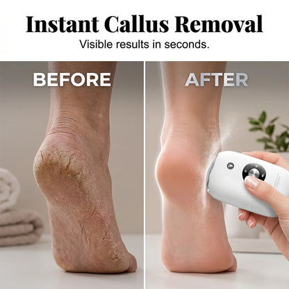 Purpose-Built Compact Automatic Foot Pedicure Grinder for Everyday Use